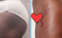 bodylift bodylift