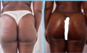 buttocks buttocks